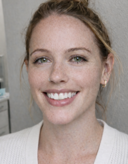 veneers in bellevue wa